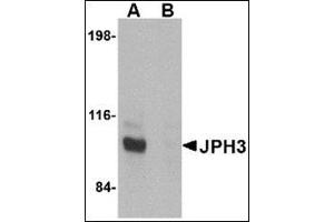 Western blot analysis of JPH3 in Daudi cell lysate with this product at 1 μg/ml in (A) the absence and (B) the presence of blocking peptide. (Junctophilin 3 antibody  (C-Term))