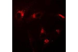 Immunofluorescent analysis of USP10 staining in A549 cells. (USP10 antibody)