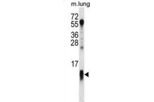 Western Blotting (WB) image for anti-Cytochrome C Oxidase Subunit VIIa Polypeptide 1 (Muscle) (COX7A1) antibody (ABIN2998452)