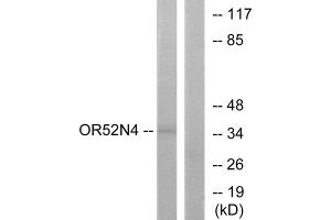 Western blot analysis of extracts from HeLa cells, using OR52N4 antibody. (OR52N4 antibody  (C-Term))