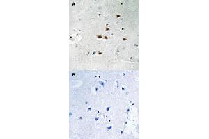 Immunohistochemical staining of human brain tissue by ITCH (phospho Y420) polyclonal antibody  without blocking peptide (A) or preincubated with blocking peptide (B) under 1:50-1:100 dilution. (ITCH antibody  (pTyr420))