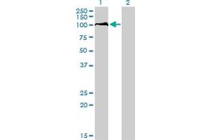 Western Blot analysis of DDX54 expression in transfected 293T cell line by DDX54 monoclonal antibody (M01), clone 2H6. (DDX54 antibody  (AA 778-881))