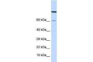WB Suggested Anti-ZNF251 Antibody Titration:  0. (ZNF251 antibody  (Middle Region))