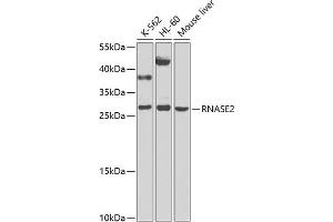 Western blot analysis of extracts of various cell lines, using RN antibody (ABIN6131626, ABIN6146986, ABIN6146987 and ABIN6225283) at 1:1000 dilution. (RNASE2 antibody  (AA 28-161))