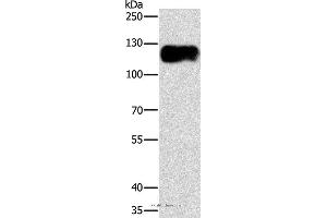 Western blot analysis of Lovo cell, using CAST Polyclonal Antibody at dilution of 1:750 (Calpastatin antibody)