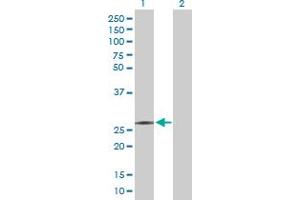 Western Blot analysis of RFXANK expression in transfected 293T cell line by RFXANK MaxPab polyclonal antibody. (RFXANK antibody  (AA 1-237))