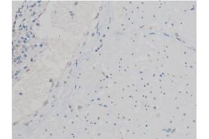 ABIN6267390 at 1/200 staining Human esophagus tissue sections by IHC-P. (ATF2 antibody  (pThr53, pThr71))