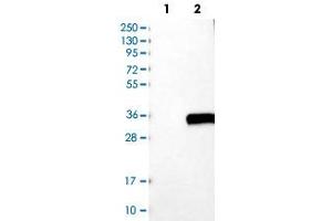 Western blot analysis of Lane 1: Negative control (vector only transfected HEK293T lysate), Lane 2: Over-expression Lysate (Co-expressed with a C-terminal myc-DDK tag (~3. (C1QA antibody)
