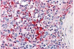 Human Spleen: Formalin-Fixed, Paraffin-Embedded (FFPE) (TLN1 antibody  (AA 1052-1150))