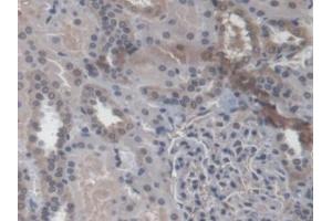 Detection of RAB37 in Human Kidney Tissue using Polyclonal Antibody to RAB37, Member RAS Oncogene Family (RAB37) (RAB37 antibody  (AA 19-220))
