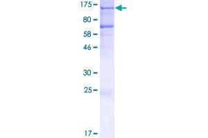 Retinoblastoma Binding Protein 8 Protein (RBBP8) (AA 1-897) (GST tag)