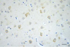 Immunohistochemistry was performed on paraffin-embedded mouse brain using CD19 antibody (ABIN7797954), 1:200). (Recombinant CD19 antibody)