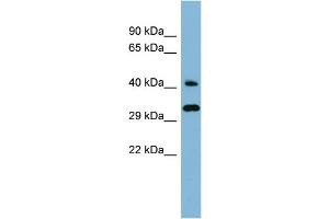 WB Suggested Anti-RBJ Antibody Titration: 0. (DNAJC27 antibody  (Middle Region))