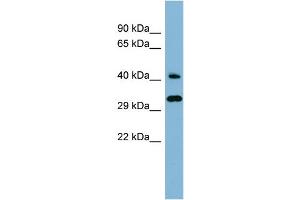 WB Suggested Anti-RBJ Antibody Titration: 0.