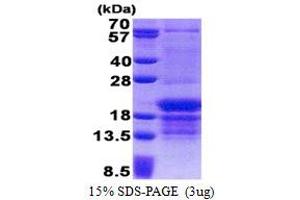 SDS-PAGE (SDS) image for Poly(rC) Binding Protein 1 (PCBP1) (AA 1-163) protein (His tag) (ABIN5853223)