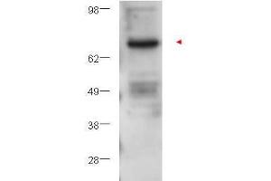 Western blot using  affinity purified anti-PKC beta antibody shows detection of PKC beta in ~25 ? (PKC beta antibody  (Internal Region))