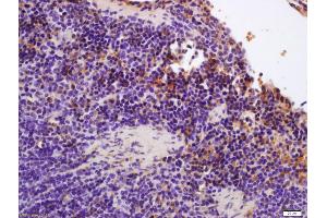 Formalin-fixed and paraffin embedded rat heart tissue labeled with Anti-PER2/Period circadian protein 2 Polyclonal Antibody, Unconjugated (ABIN1387969) at 1:200 followed by conjugation to the secondary antibody and DAB staining (Hemoglobin Alpha 1 + 2 (HBA1,HBA2) (AA 10-60) antibody)