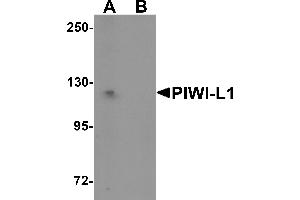 Western Blotting (WB) image for anti-Piwi-Like 1 (PIWIL1) (N-Term) antibody (ABIN1031515) (PIWIL1 antibody  (N-Term))