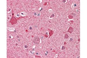 Anti-DOC2A antibody IHC staining of human brain, cortex.