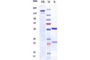 Anti-OSMR Reference Antibody (vixarelimab) on SDS-PAGE under reducing (R) condition. (Recombinant OSMR (Vixarelimab Biosimilar) antibody)