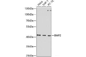 Western blot analysis of extracts of various cell lines using BMP2 Polyclonal Antibody at dilution of 1:1000. (BMP2 antibody)