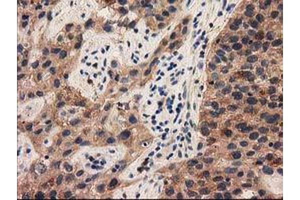 PYCRL antibody