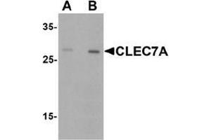Western blot analysis of CLEC7A in rat spleen tissue lysate with CLEC7A antibody at (A) 1 and (B) 2 µg/. (CLEC7A antibody  (Middle Region))