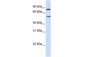 WB Suggested Anti-SLC27A4 Antibody Titration:  0. (SLC27A4 antibody  (Middle Region))