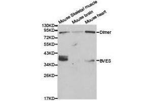 Western Blotting (WB) image for anti-Blood Vessel Epicardial Substance (BVES) antibody (ABIN1871374) (BVES antibody)