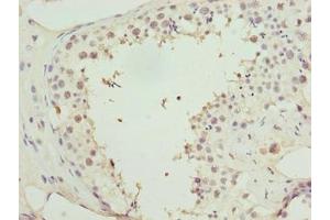 Immunohistochemistry of paraffin-embedded human testis tissue using ABIN7155453 at dilution of 1:100 (Retinoblastoma Binding Protein 4 antibody  (AA 246-425))