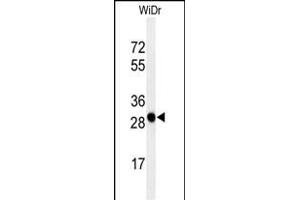 Western blot analysis of QR3 Antibody (C-term) (ABIN650916 and ABIN2839993) in WiDr cell line lysates (35 μg/lane).