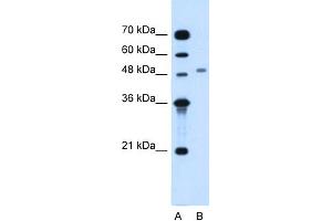 WB Suggested Anti-MGAT2 Antibody Titration:  1. (MGAT2 antibody  (Middle Region))