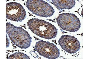 IHC analysis of ME1 using anti-ME1 antibody (ABIN7599485). (ME1 antibody  (AA 1-572))