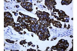 Image no. 2 for anti-ATP-Binding Cassette, Sub-Family B (MDR/TAP), Member 1 (ABCB1) (AA 995-1280) antibody (ABIN1491724) (ABCB1 antibody  (AA 995-1280))