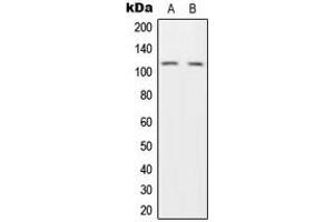 Western blot analysis of HGS expression in H1299 (A), HeLa (B) whole cell lysates. (HGS antibody  (Center))