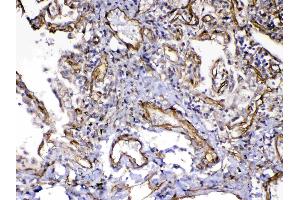 IHC analysis of VEGF Receptor 3 using anti-VEGF Receptor 3 antibody . (FLT4 antibody)