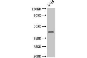 Western Blot Positive WB detected in: A549 whole cell lysate All lanes: NDRG4 antibody at 2 μg/mL Secondary Goat polyclonal to rabbit IgG at 1/50000 dilution Predicted band size: 39, 38, 41, 43, 40 kDa Observed band size: 43 kDa (NDRG4 antibody  (AA 210-331))