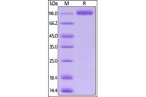SDS-PAGE (SDS) image for Fms-Related tyrosine Kinase 1 (VEGFR1) (FLT1) (AA 27-756) (Active) protein (His tag,AVI tag,Biotin) (ABIN5955009)