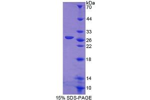 SDS-PAGE (SDS) image for Collapsin Response Mediator Protein 1 (CRMP1) (AA 1-250) protein (His tag) (ABIN6238965) (CRMP1 Protein (AA 1-250) (His tag))