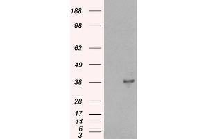 HEK293 overexpressing DOK5 (ABIN5345413) and probed with ABIN185292 (mock transfection in first lane).