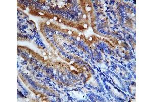 IHC-P: CX3CL1 antibody testing of rat intestine tissue (CX3CL1 antibody  (N-Term))