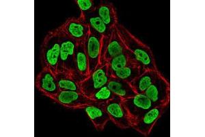 Immunofluorescence (IF) image for anti-DNA (Cytosine-5-)-Methyltransferase 3 beta (DNMT3B) (AA 1-150) antibody (ABIN5542517)