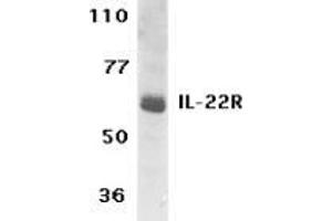 Western blot analysis of IL-22 Receptor expression in human HepG2 cell lysate with AP30416PU-N IL-22 Receptor antibody at 1 μg /ml. (IL22 Receptor alpha 1 antibody  (C-Term))