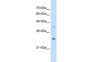 Western Blotting (WB) image for anti-Calcyclin Binding Protein (CACYBP) antibody (ABIN2463420) (CACYBP antibody)