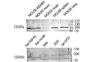 Western Blot (WB) analysis of Rat Kidney HeLa 293T SH-SY5Y Mouse Kidney, Mouse Spleen, Mouse Lung, using ENPP3 Polyclonal Antibody. (ENPP3 antibody  (Internal Region))