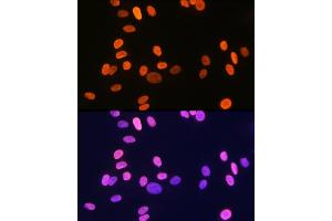 Immunofluorescence analysis of U-2 OS cells using Histone H1. (HIST1H1C antibody)