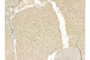 ABIN6262191 and ABIN6269396 at 1/100 staining human normal liver tissue by IHC-P.