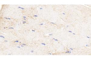 Detection of H-FABP in Bovine Skeletal muscle Tissue using Polyclonal Antibody to Heart-type Fatty Acid Binding Protein (H-FABP)