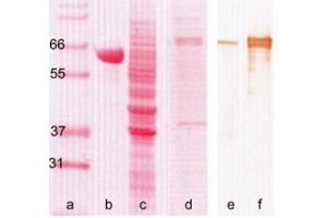 Western Blotting (WB) image for anti-Myxovirus Resistance Protein 1 (MX1) antibody (ABIN781793) (MX1 antibody)
