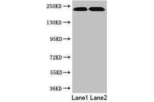 Western blot All lanes: TLN2 antibody at 12 μg/mL Lane 1: Hela whole cell lysate Lane 2: Jurkat whole cell lysate Secondary Goat polyclonal to rabbit IgG at 1/10000 dilution Predicted band size: 272 kDa Observed band size: 230 kDa (TLN2 antibody  (AA 88-406))